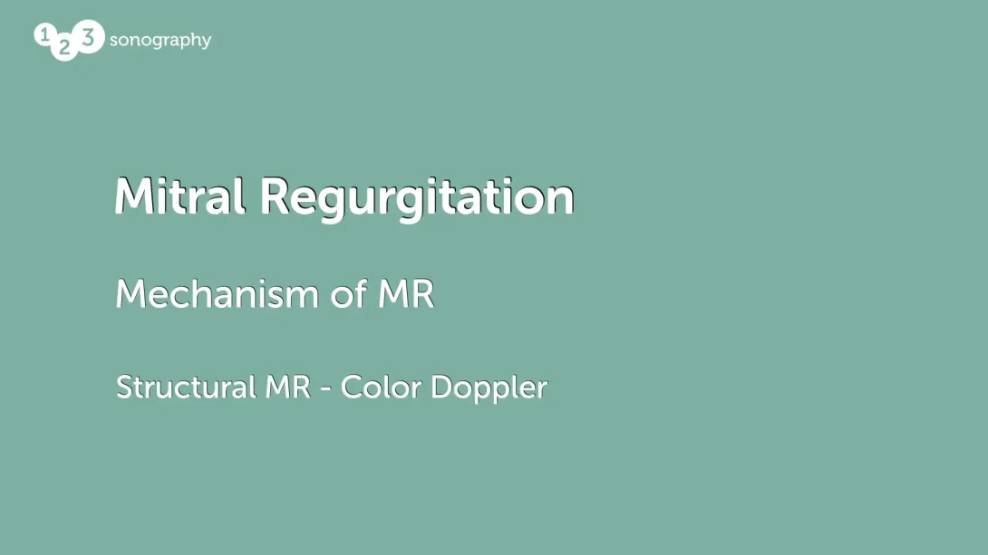 Structural MR - Color Doppler