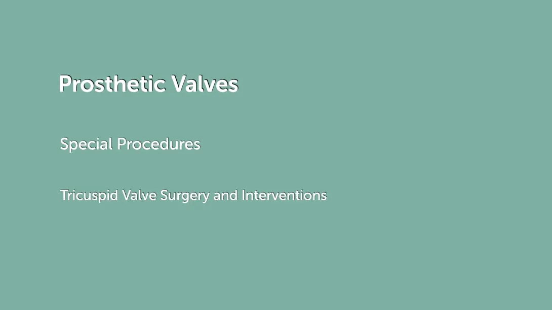 Tricuspid Valve