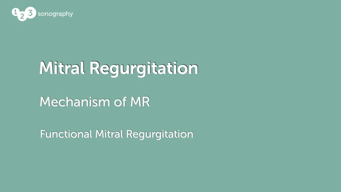 Mechanism Mitral - functional MR