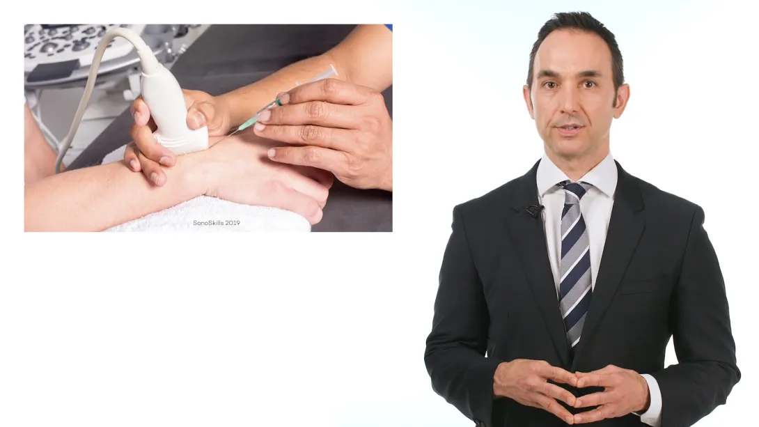Radiocarpal joint Injection