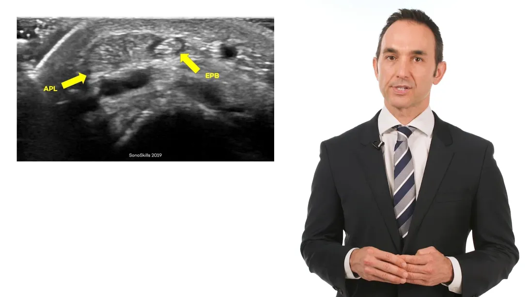 Thumb CMC joint Injection