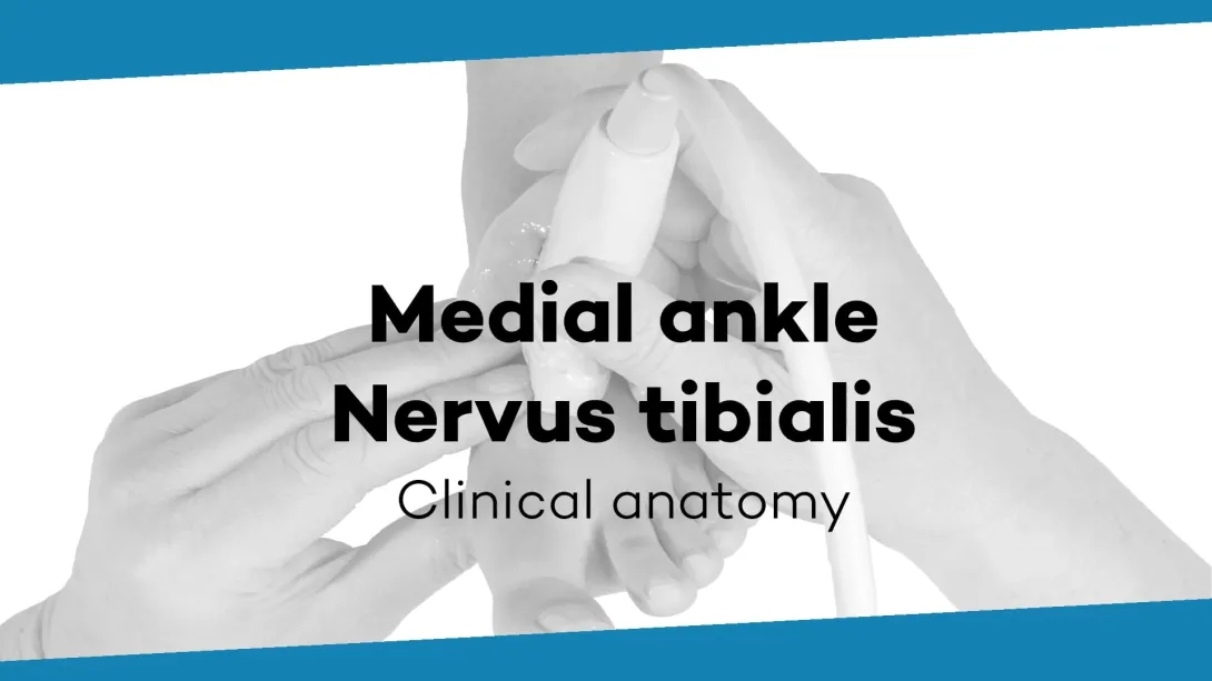 Tibial nerve