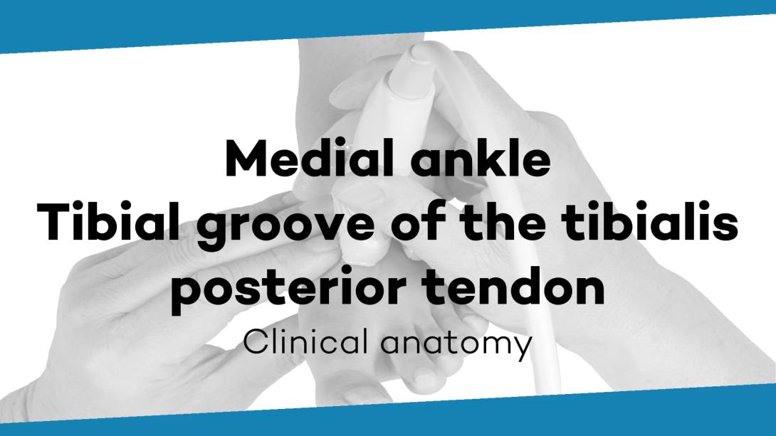 Tibial groove of the tibialis posterior tendon
