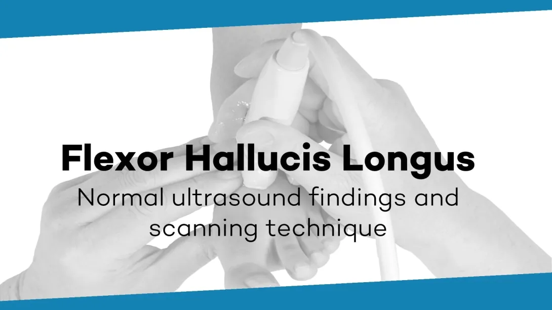 M. flexor hallucis longus