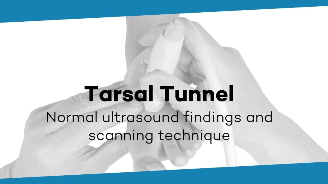 Medioposterior tarsal tunnel overview