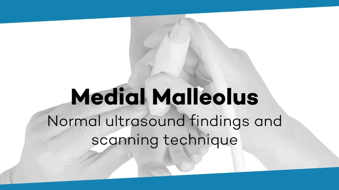 Medial malleolus
