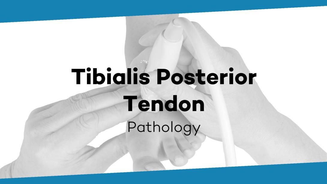Abnormalities of the tibialis posterior tendon