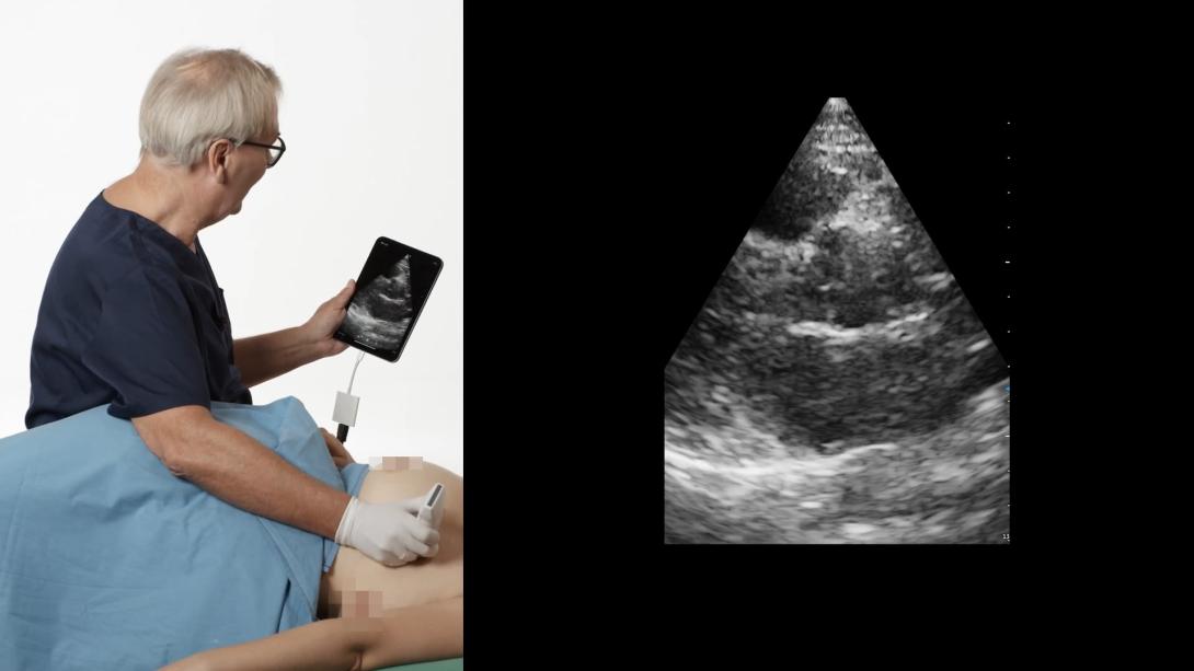 Introduction to echocardiography: Thomas' favourite