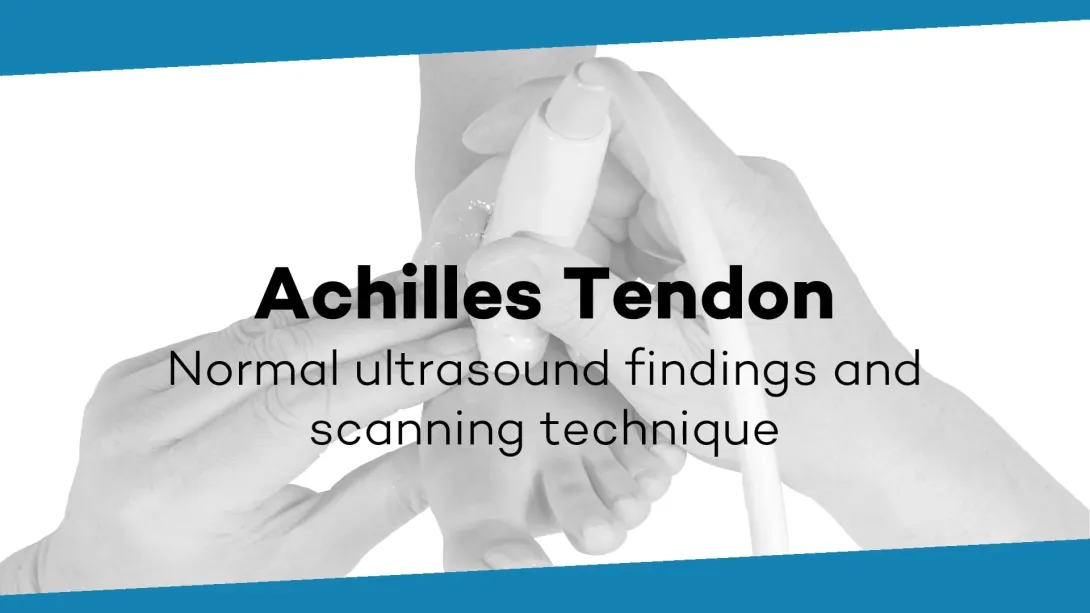Achilles tendon