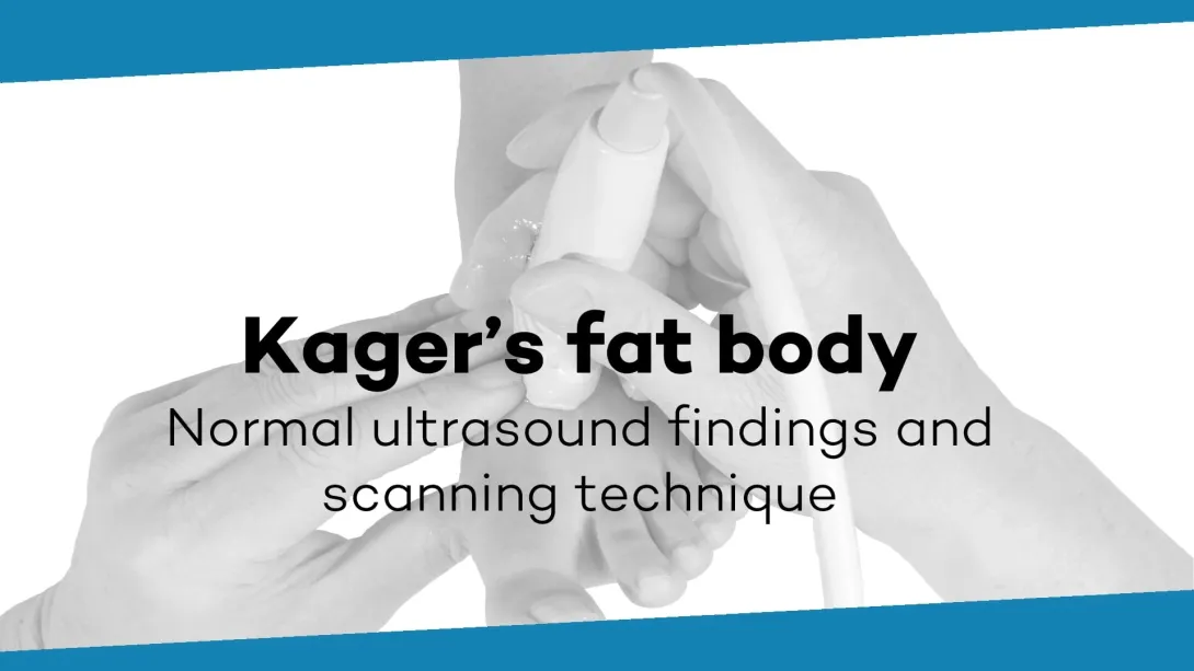 Kager's fat body