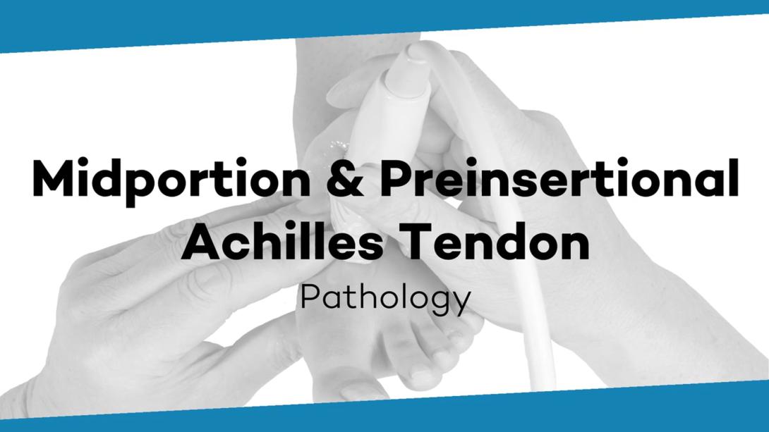 Midportion and preinsertional pathology of the Achilles tendon