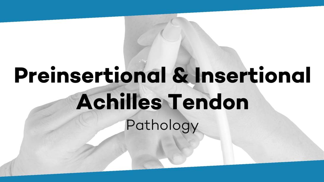 Preinsertional and insertional pathology of the Achilles tendon