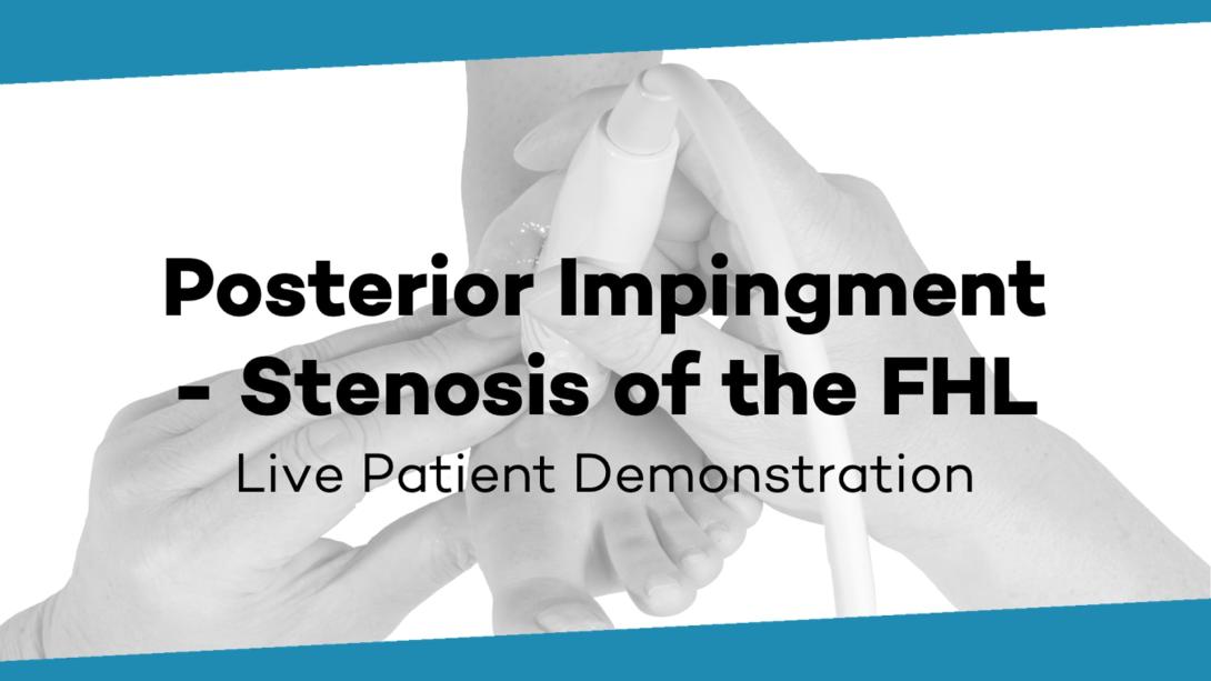 Posterior impingement - stenosis of the FHL