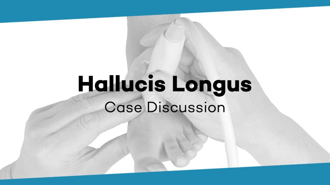 Case Discussion: Hallucis longus