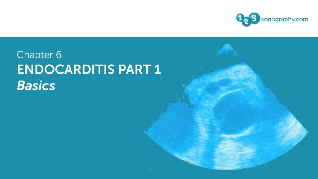 Endocarditis Part 1 - Basics