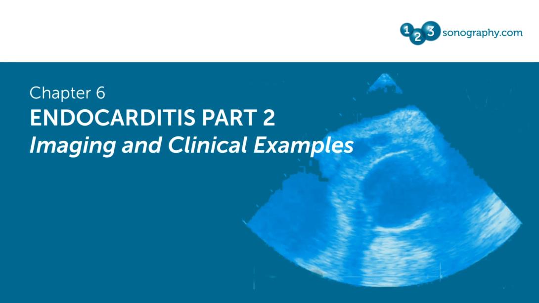 Endocarditis Part 2 - Imaging and Clinical Examples