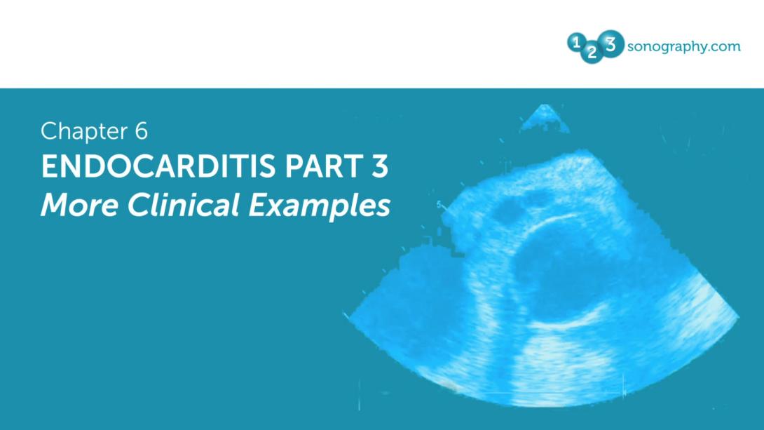 Endocarditis Part 3 - More Clinical Examples