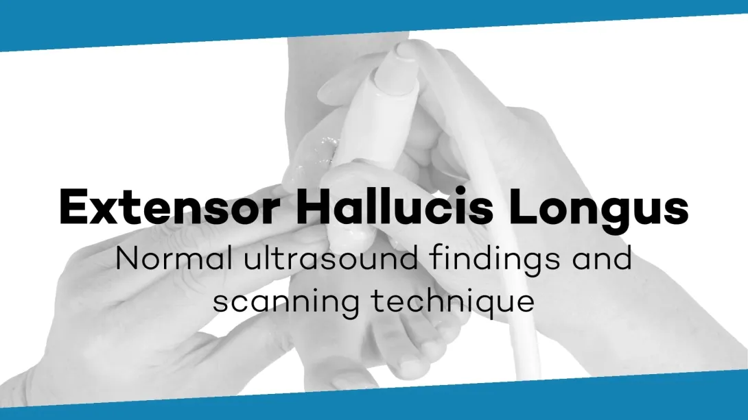 M. extensor hallucis longus
