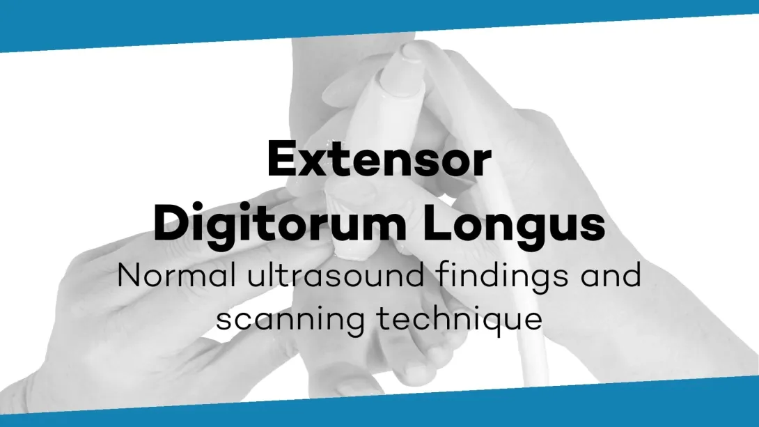 M. extensor digitorum longus
