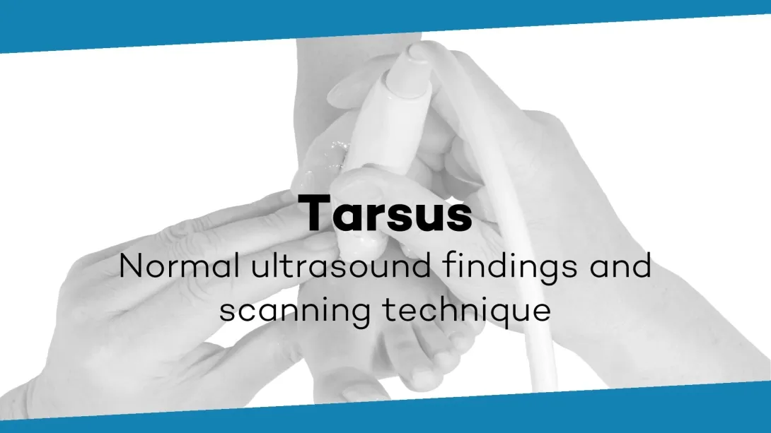Tarsus