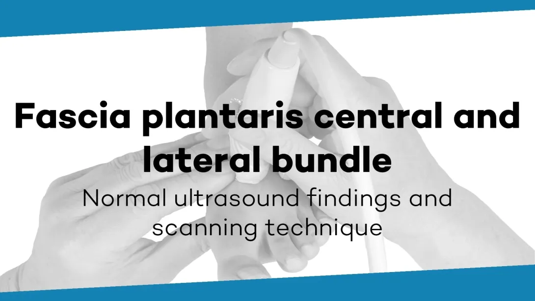 Fascia plantaris, central and lateral bundle