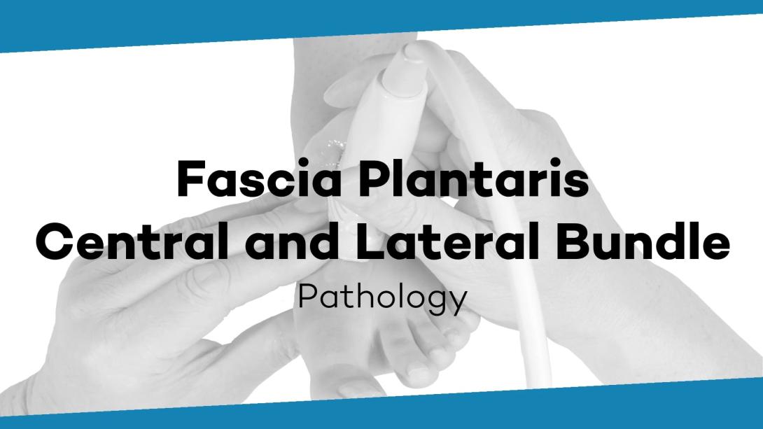 Fasciitis plantaris, fascial ruptures, plantar fibromatosis, fat chamber lesion