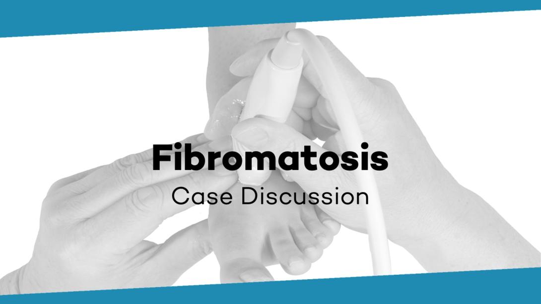Case Discussion: Fibromatosis