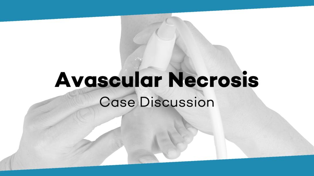 Case Discussion: Avascular necrosis