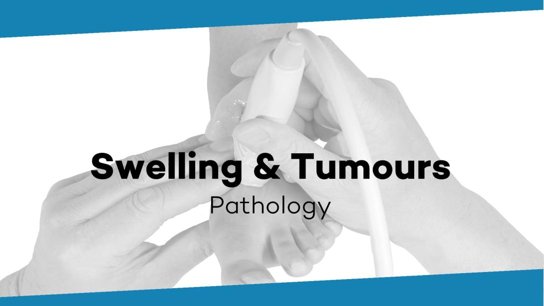 Swelling & Tumours