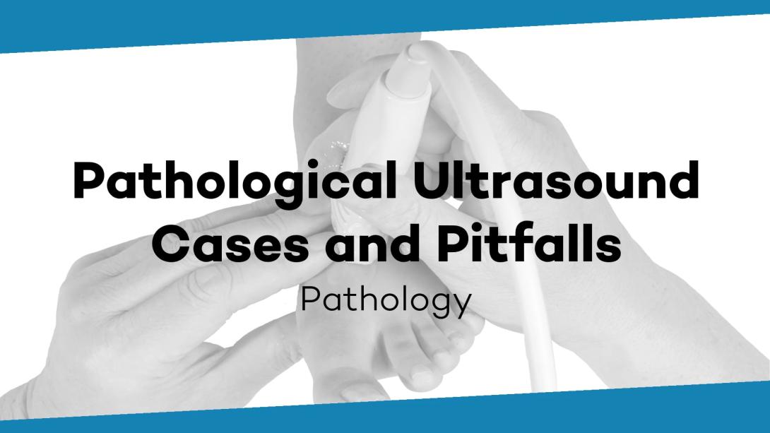 Ultrasound cases and pitfalls