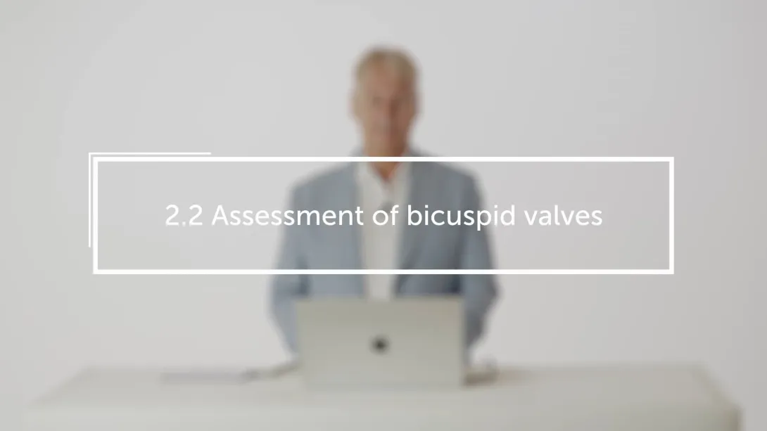 Assessment of bicuspid valves