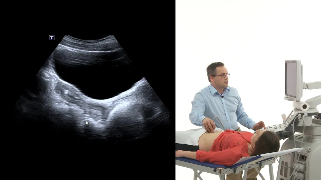 Female pelvis: Anatomy and How to image