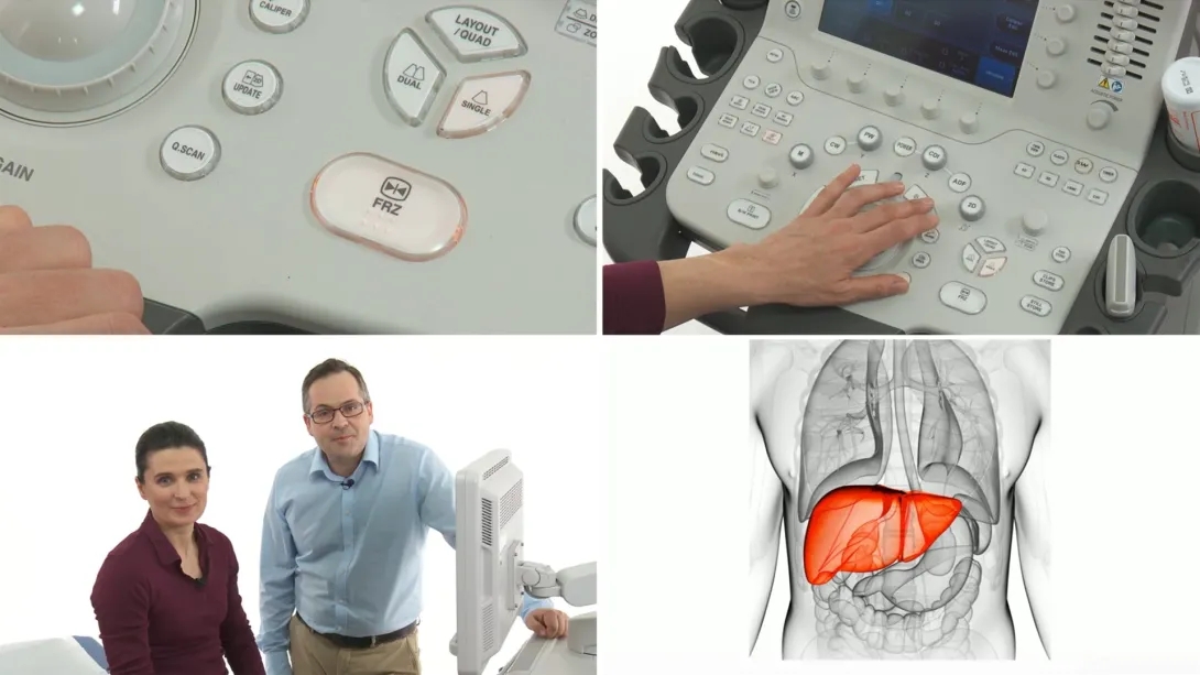 Female pelvis: Pathologies