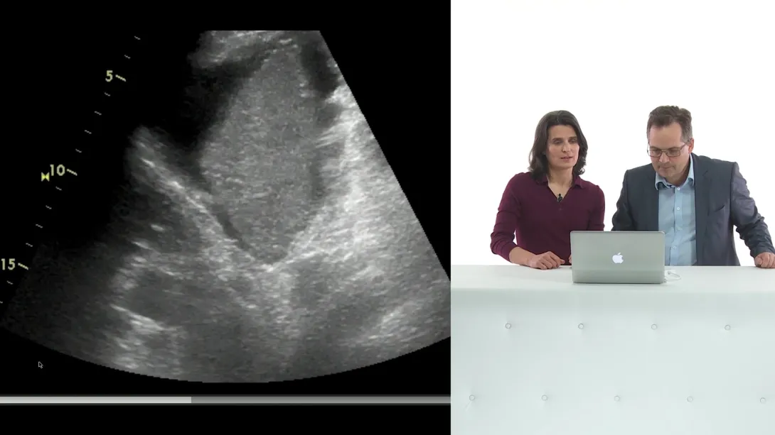 Liver: Case reports