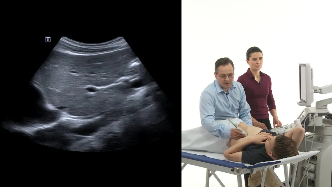 Gallbladder: Anatomy and How to image