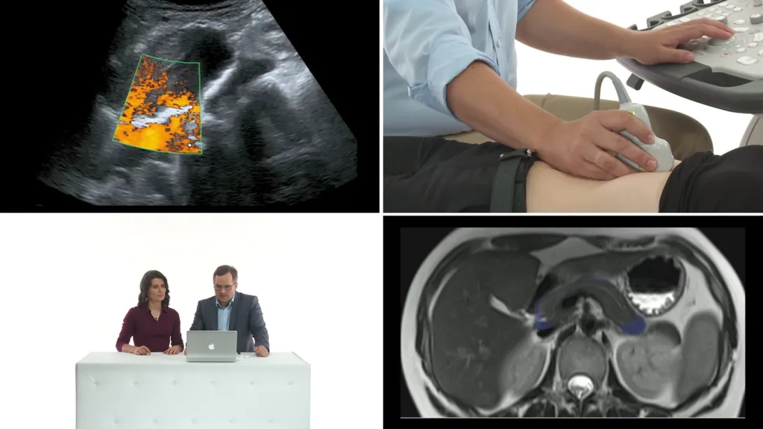 Kidneys: How to image 1
