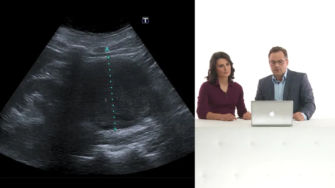 Kidneys: Case reports