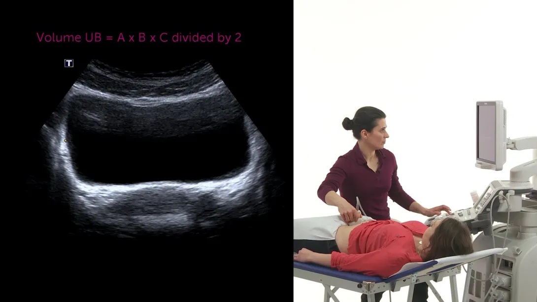 Urinary bladder: Pathologies