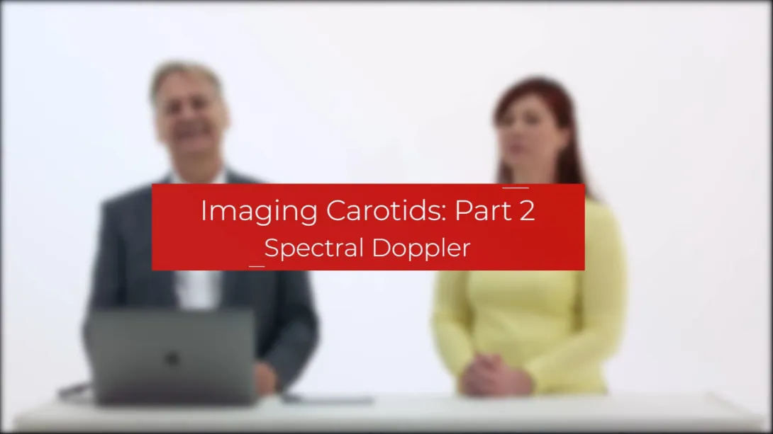 Spectral Doppler
