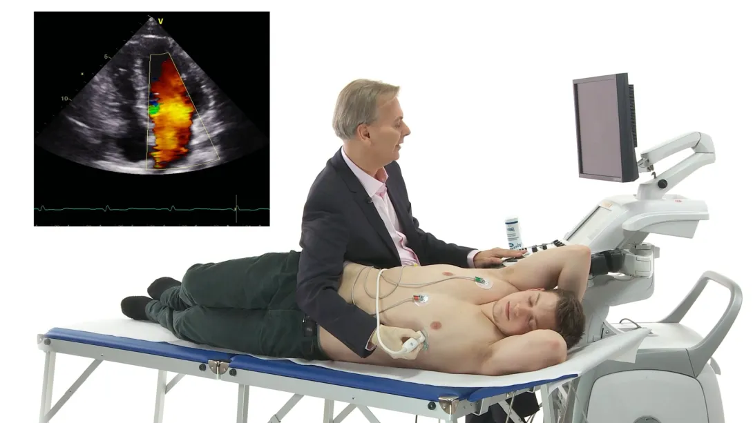 03 - Starter Kit-  Mitral regurgitation