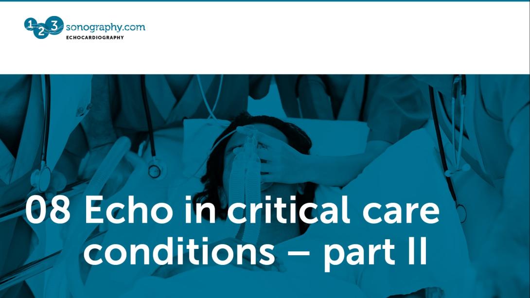 08 - Echo in critical care conditions - part 2