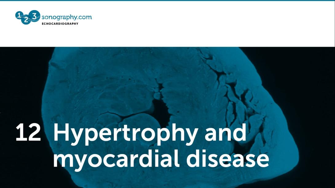 12 - Hypertrophy and myocardial disease