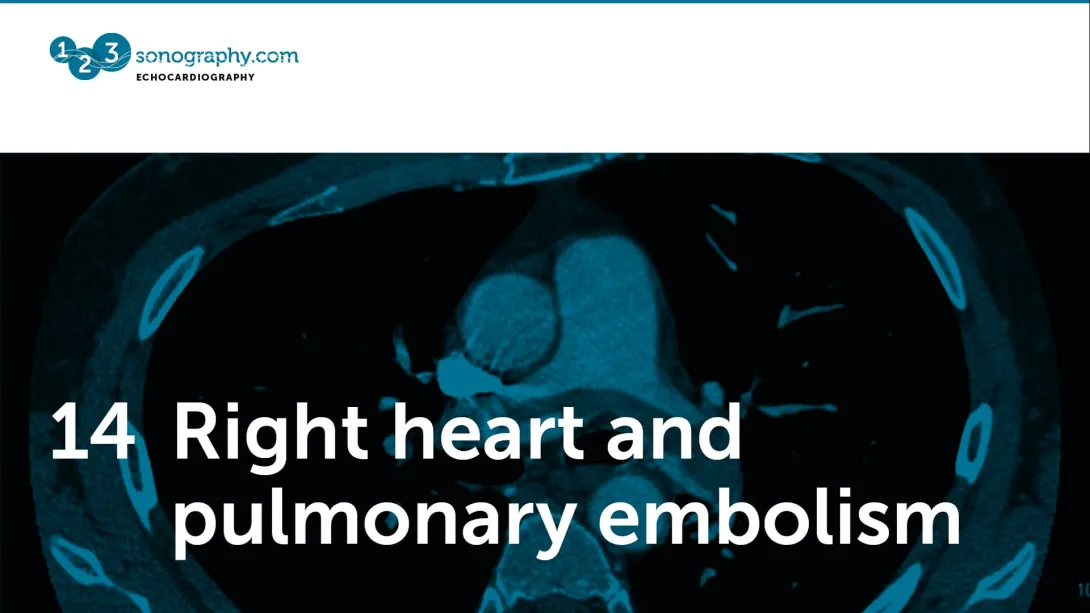 14 - Right heart and pulmonary embolism