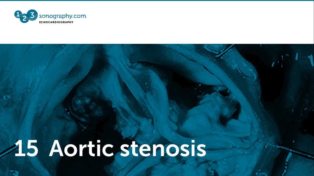 15 - Aortic stenosis