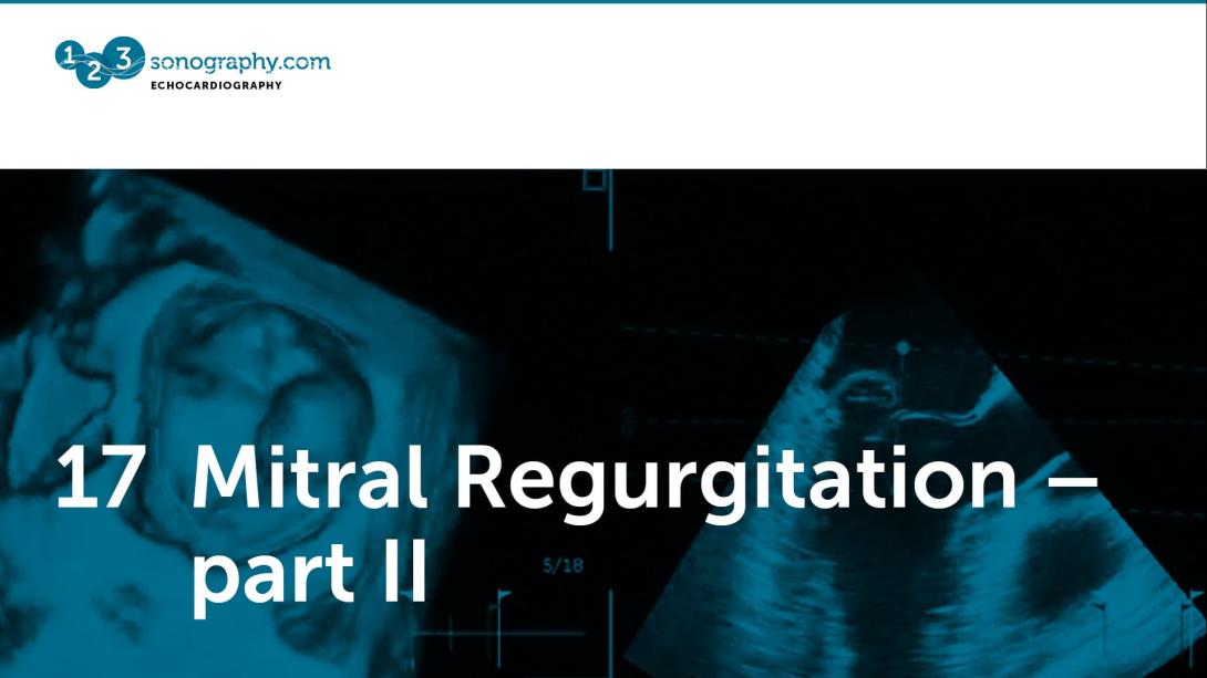 17 - Mitral regurgitation part 2