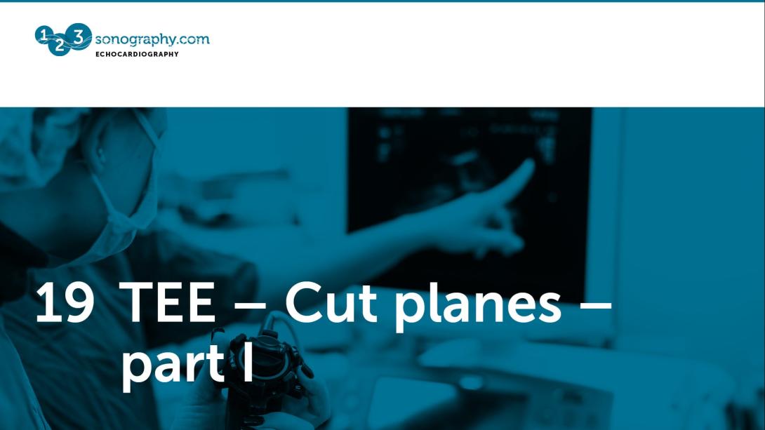19 - TEE - Cut planes part 1