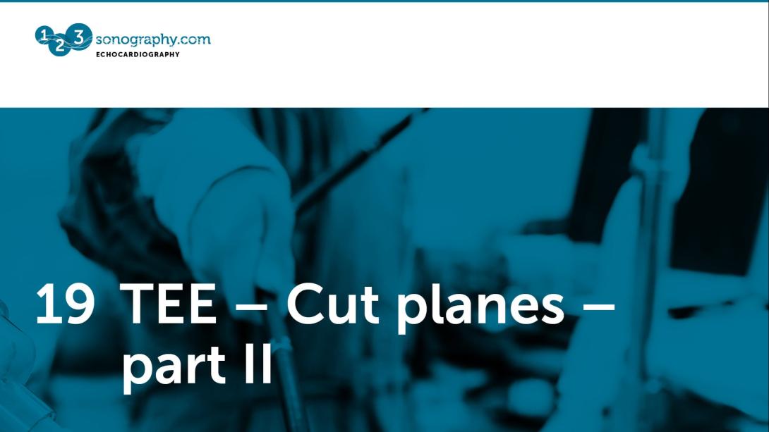 19 - TEE - Cut planes part 2