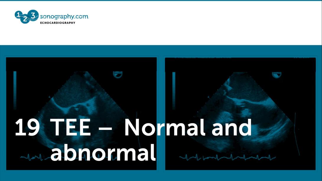 19 - TEE - Normal and abnormal
