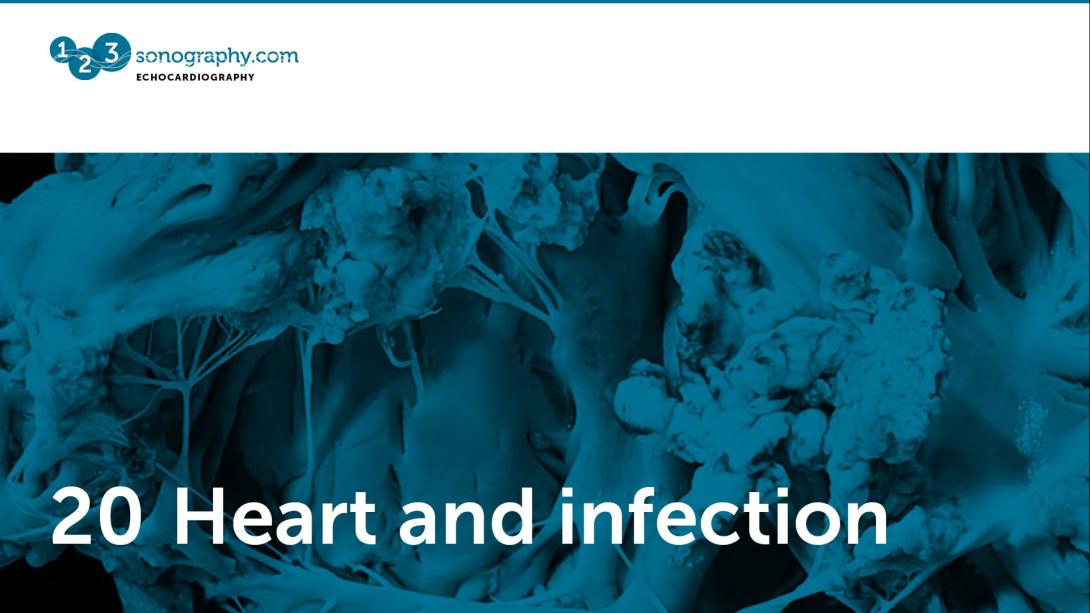 20 - Heart and infection