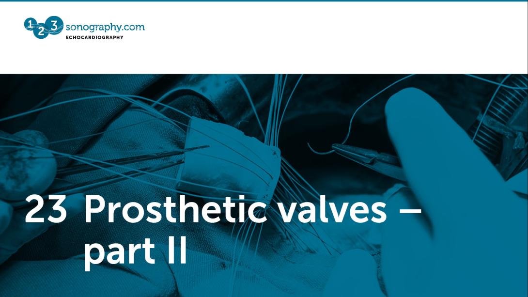 23 - Prosthetic valves part 2